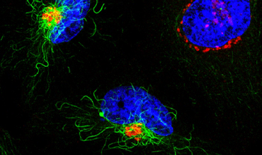 Golgi Mitotic Checkpoint